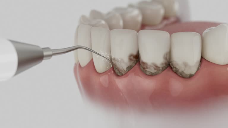 Trusted Teeth Cleaning And Checkup service in Baldwin, PA - Dentist Open Now